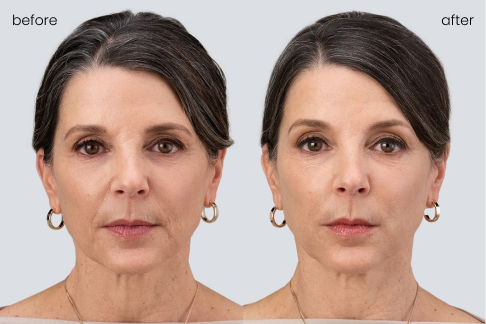 Dynamic Before & After Videos