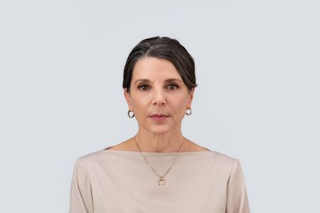 Teoxane RHA® Collection - Before & Afters - Cathy