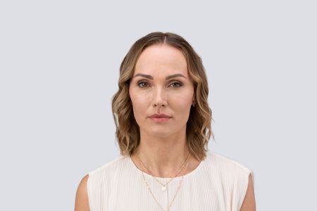 Teoxane RHA® Collection - Before & Afters - Olena