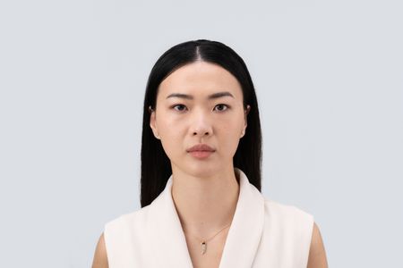 Teoxane RHA® Collection - Before & Afters - Jennifer