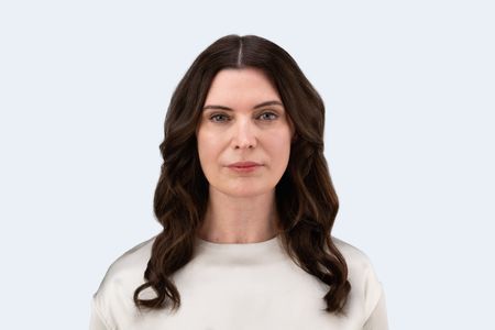 Teoxane RHA® Collection - Before & Afters - Susan