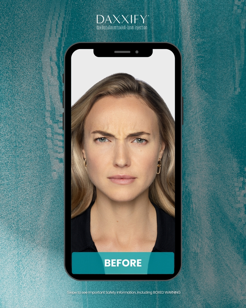 DAXXIFY® - A Smoother Chapter Awaits Social Toolkit - Option 3 Slide 2 of 7.jpg