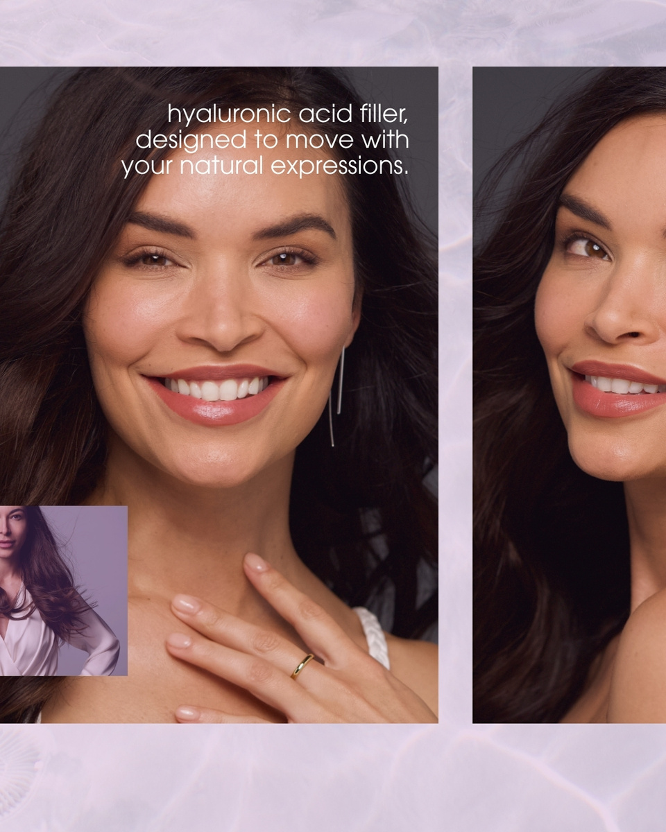 Teoxane RHA® Collection - All About Movement Social Toolkit - Option 1 Slide 2 of 5.jpg