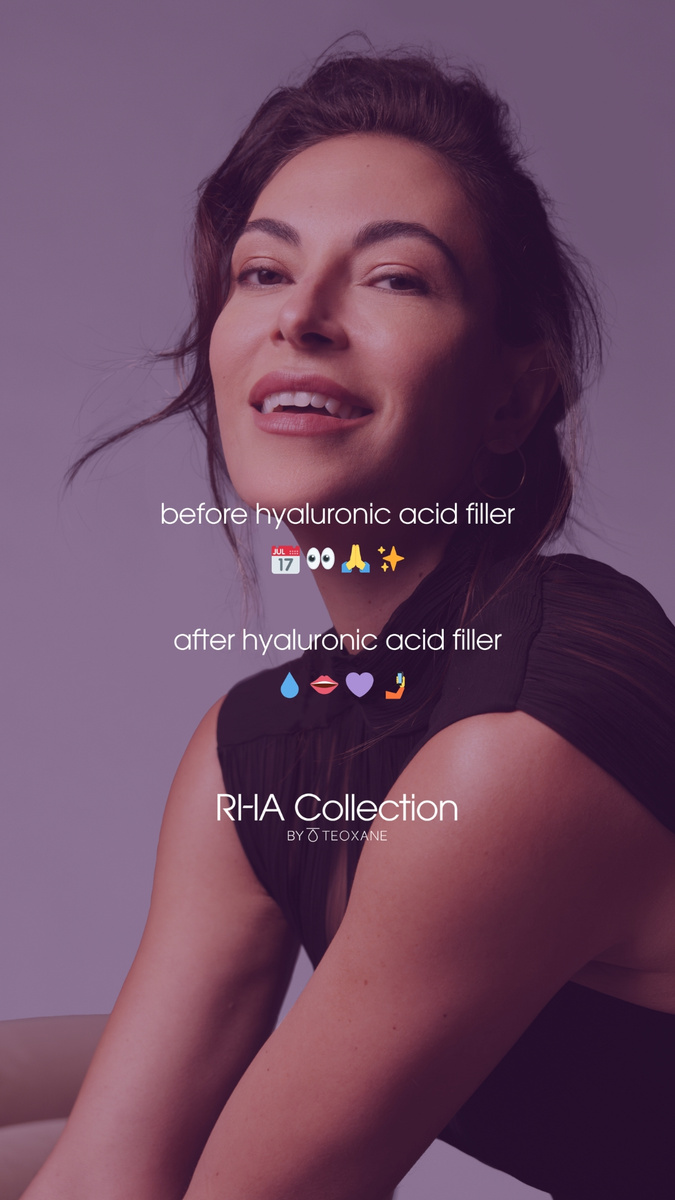 Teoxane RHA® Collection - All About Movement Social Toolkit - Option 4 Reel Cover.jpg