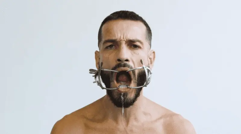 carlos motta with shite background. there is a metal medical device holding his mouth wide open