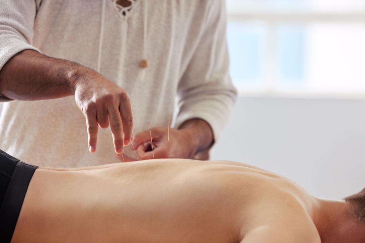 Your Acupuncture Business Plan (with Sample Template!)