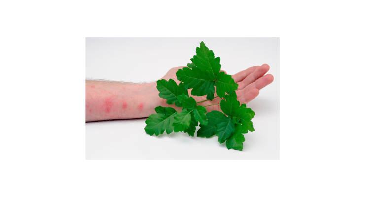 wide headshot crop for hygraph poison oak.png