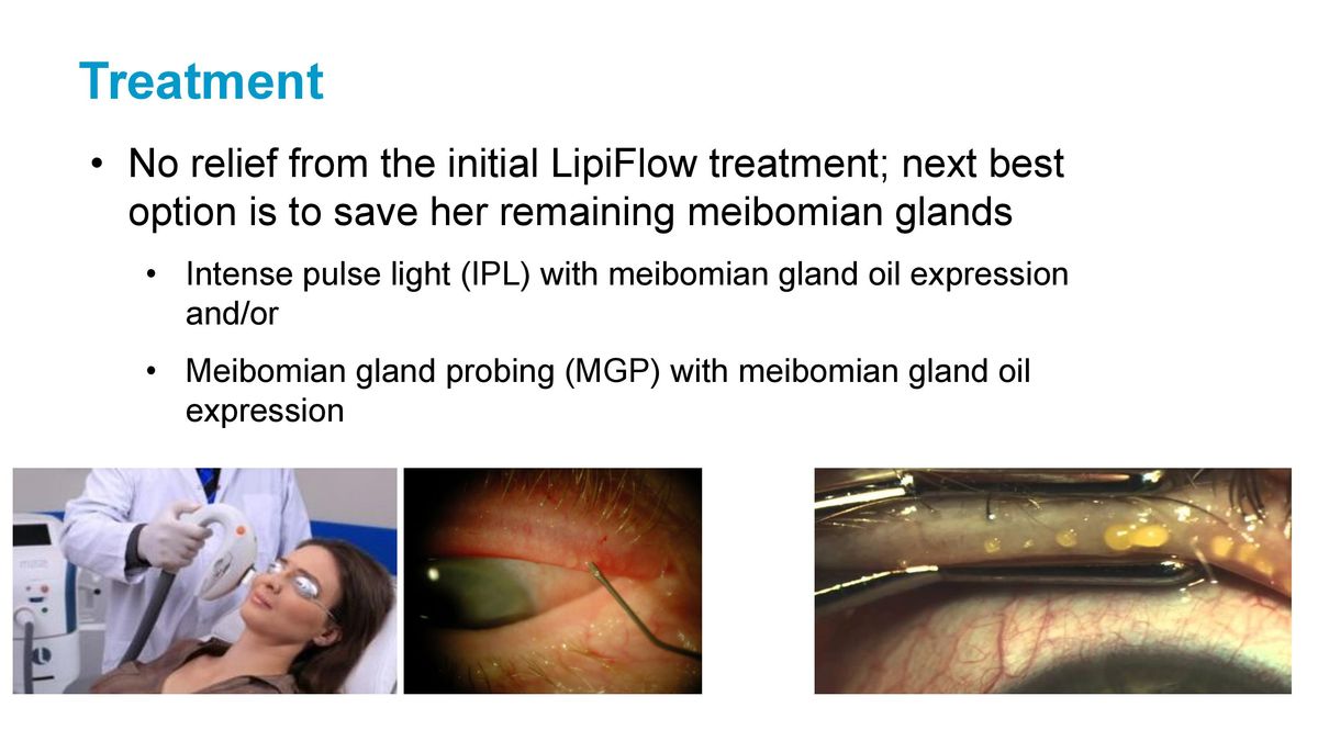 How to Treat Dry Eye Disease 2021.04.18 S.L.Cremers-page-026.jpg