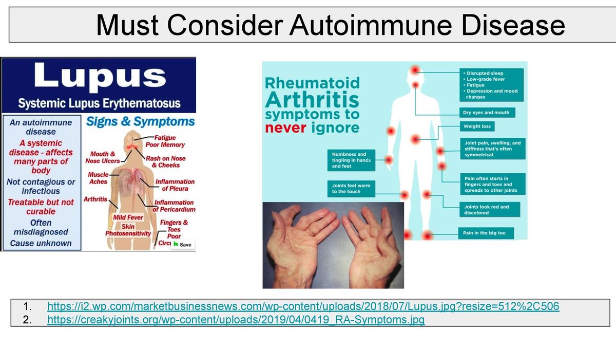 How to Treat Dry Eye Disease 2021.04.18 S.L.Cremers-page-018.jpg