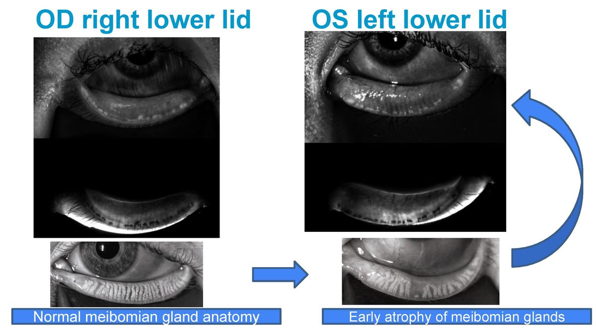 How to Treat Dry Eye Disease 2021.04.18 S.L.Cremers-page-012.jpg