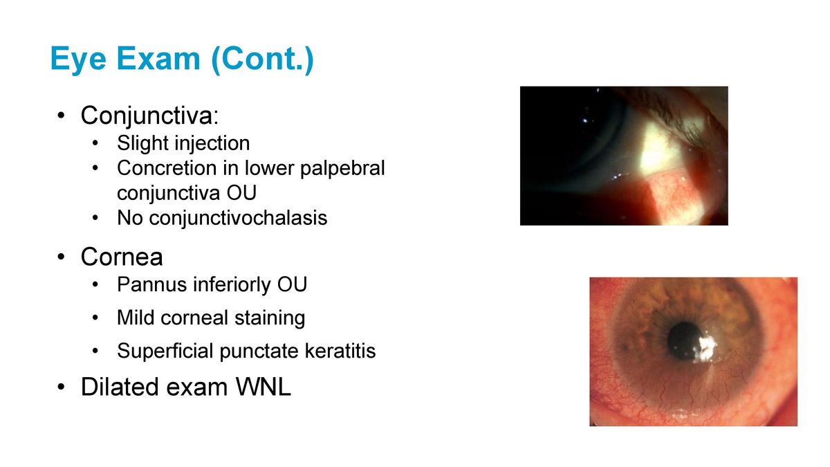 How to Treat Dry Eye Disease 2021.04.18 S.L.Cremers-page-008.jpg