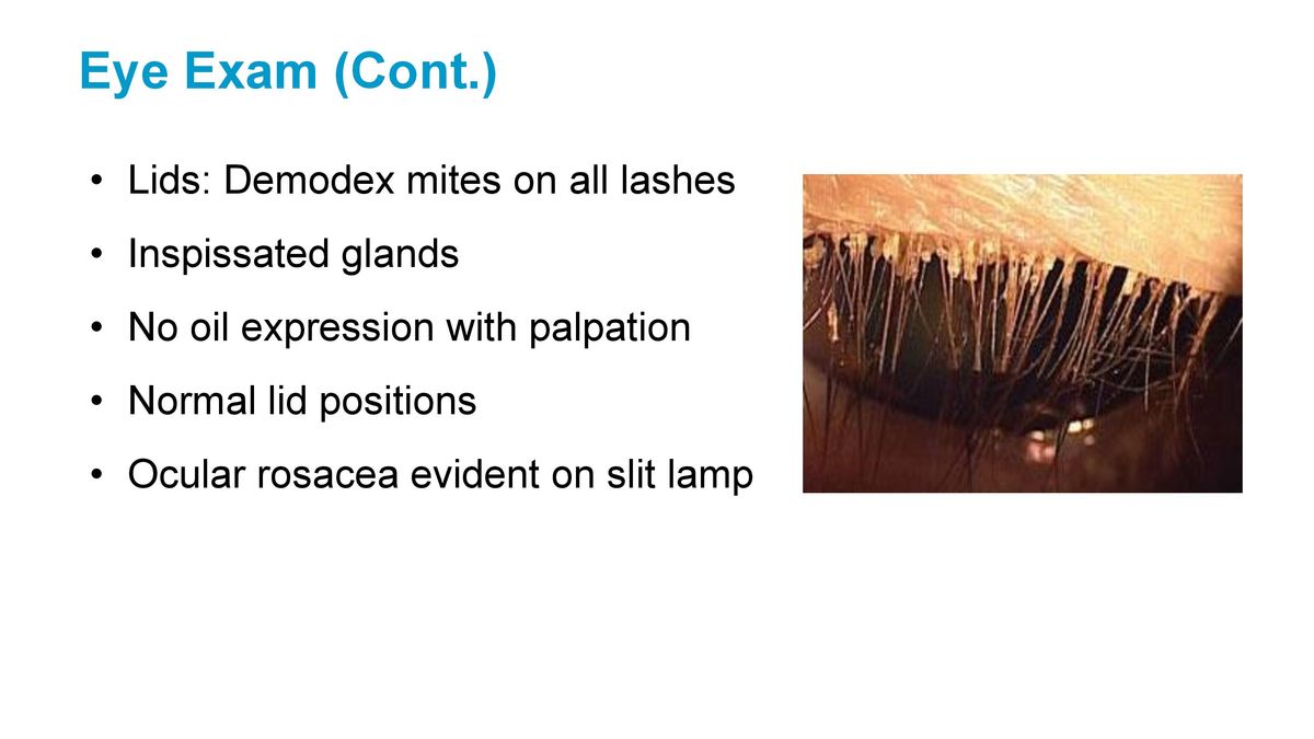 How to Treat Dry Eye Disease 2021.04.18 S.L.Cremers-page-007.jpg