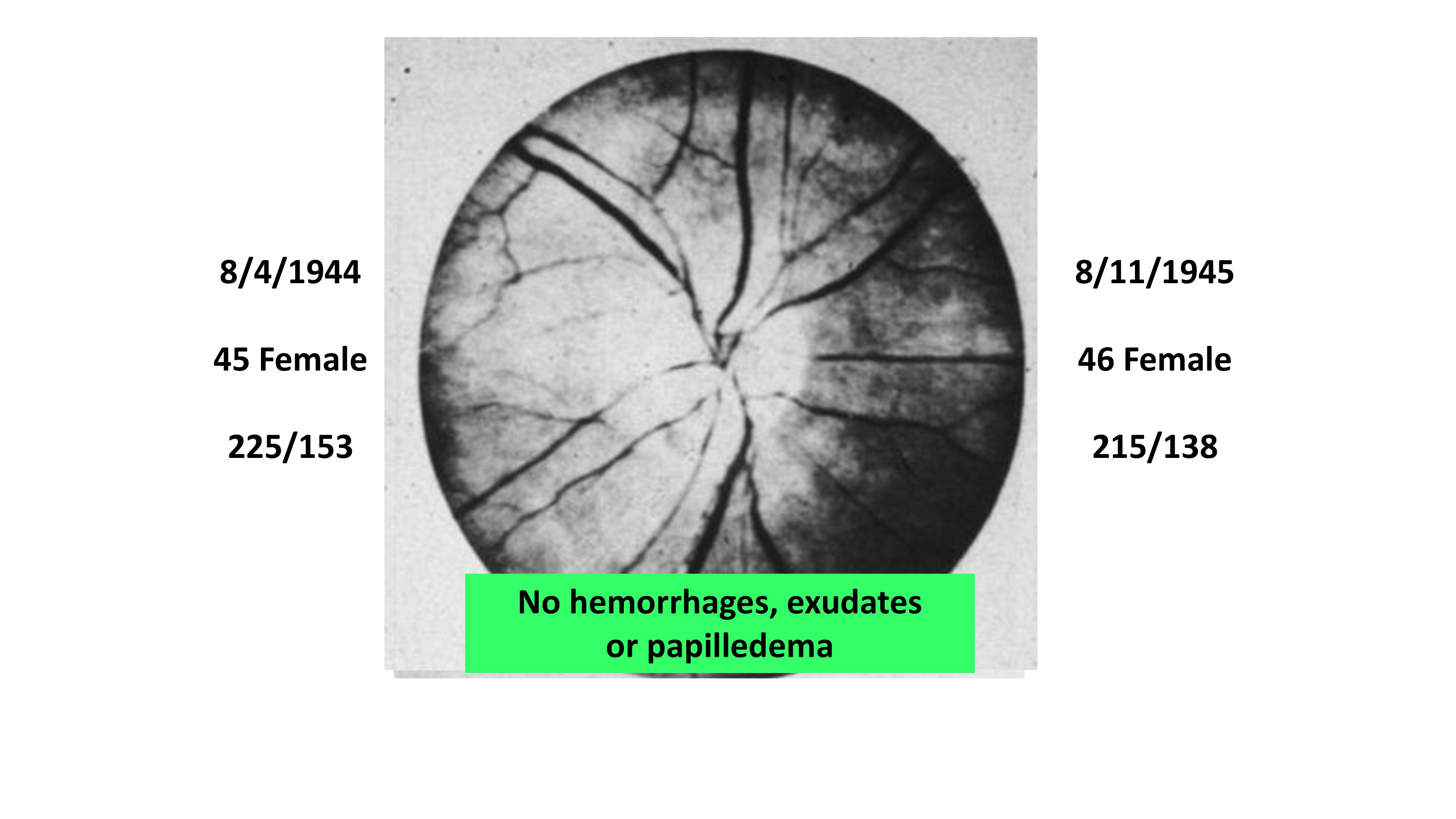 Dr. Clarence Grim HTN Update (version for blog post).pptx-page-007.jpg