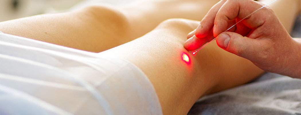 Laser sensor image version LG-2.